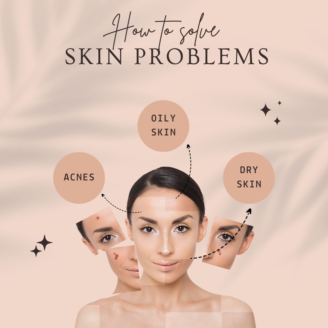Solution of All Your Skin Problems