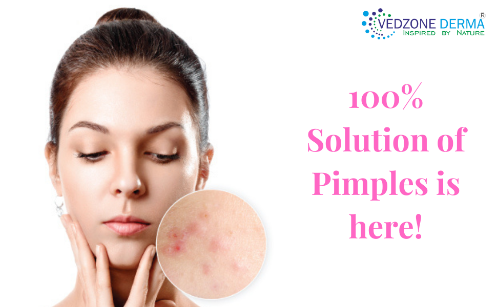 Best Acne Products Of All Times